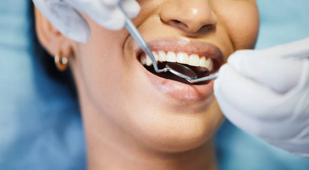Best Emergency Treatment for Dental Infections or Abscesses in Milledgeville, GA