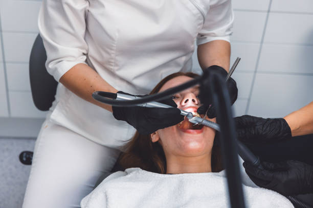 Best Emergency Wisdom Teeth Removal in Milledgeville, GA